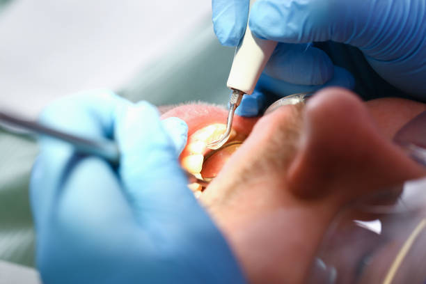 Best Holiday Emergency Dentist in Big Spring, TX